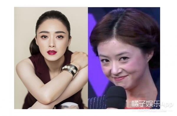 法令纹显老明星,明星怎么治法令纹