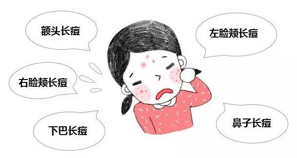 常见痘痘长什么样,常见的痘痘种类