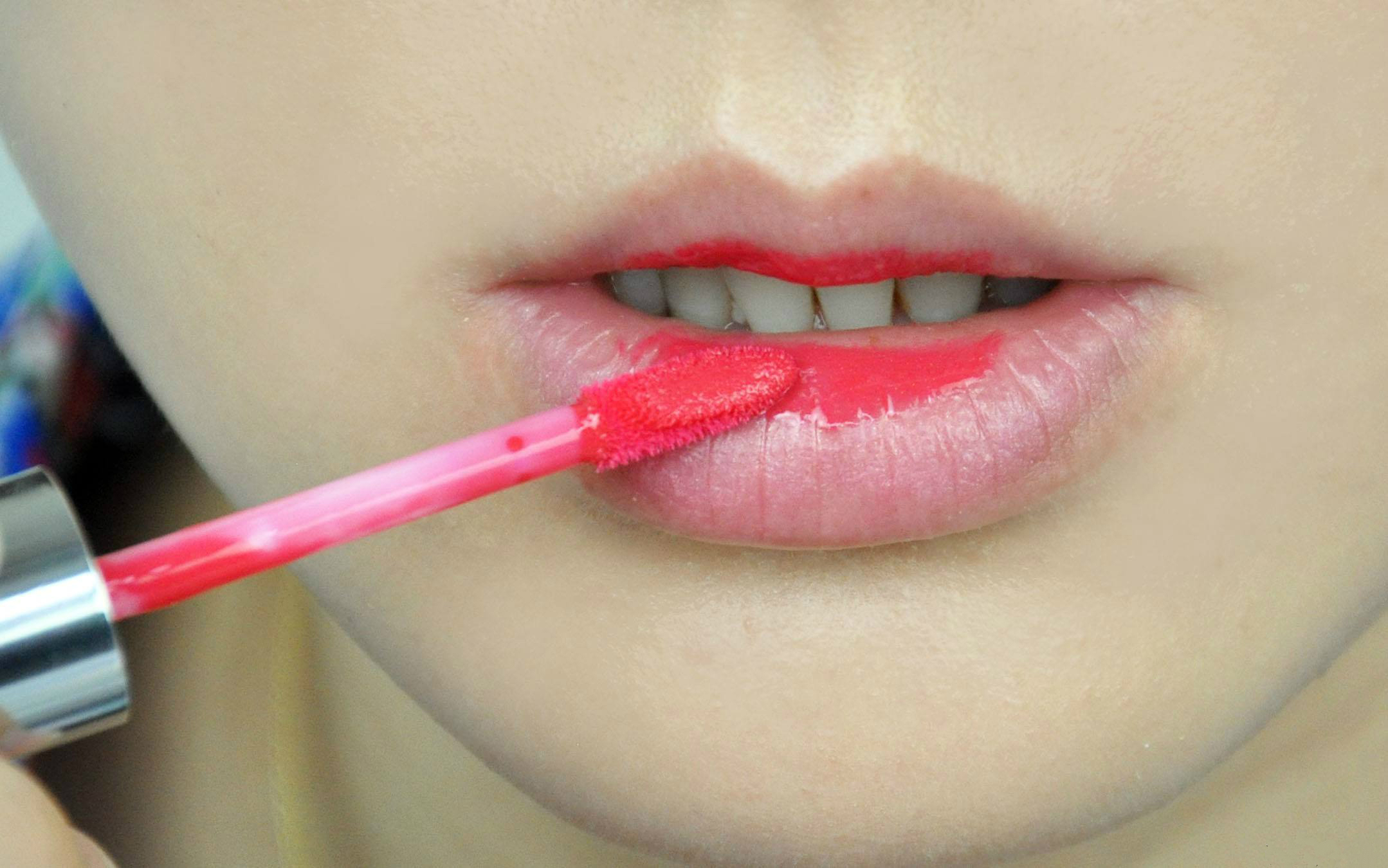 很多人嘴唇上有一道疤,为什么上嘴唇会多出一点肉