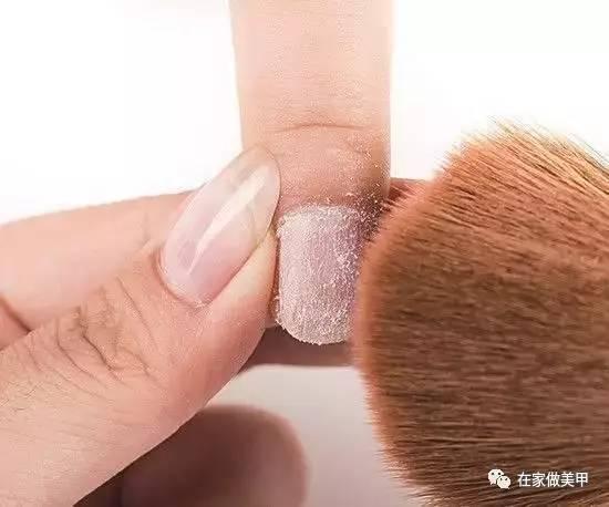 玛蒂被折断手指,玛蒂折断手指