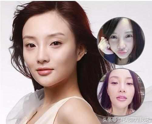 整完容真的美吗?明星整容前后对比图,没对比没伤害!