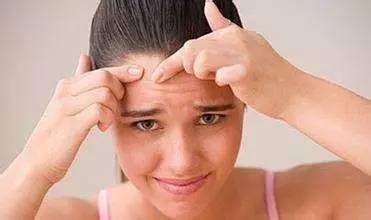 额头长痘痘后要注意哪些?