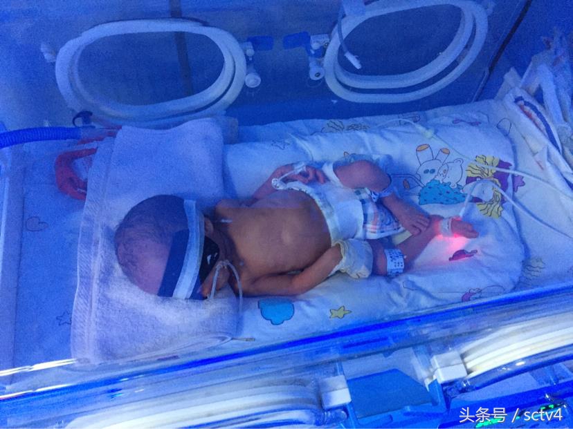 成都妈妈诞下同卵三胞胎5天准备了12包尿不湿