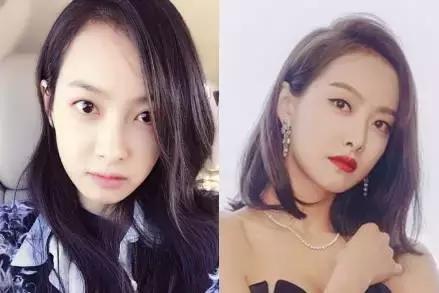 年轻人如何改善发量稀疏,发量稀少怎么补救最快最有效