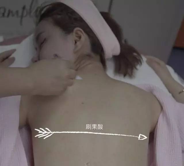 背上痘痘夏天怎么穿吊带,背后长痘痘怎么穿小吊带