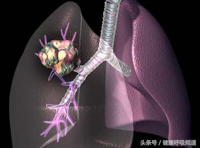 呼吸困难与气急气短区别,气短呼吸困难是什么原因