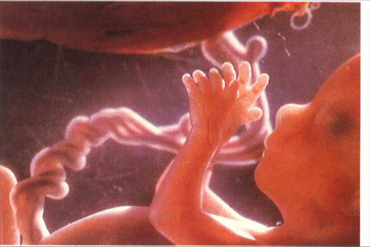 孕妇羊水是什么样子呢,孕期胎儿真的听得懂话吗