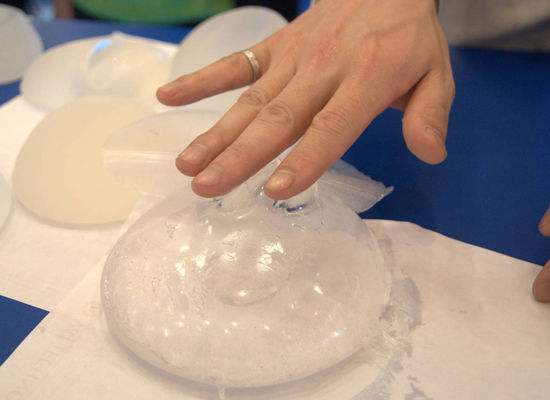 隆胸过后母乳会移位吗,隆胸了以后还能正常母乳哺乳吗