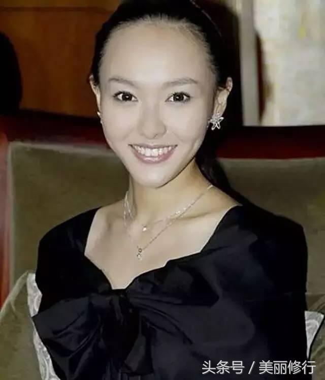 掉头发严重防脱洗发水有用吗,掉头发用防脱的洗发水有效果吗