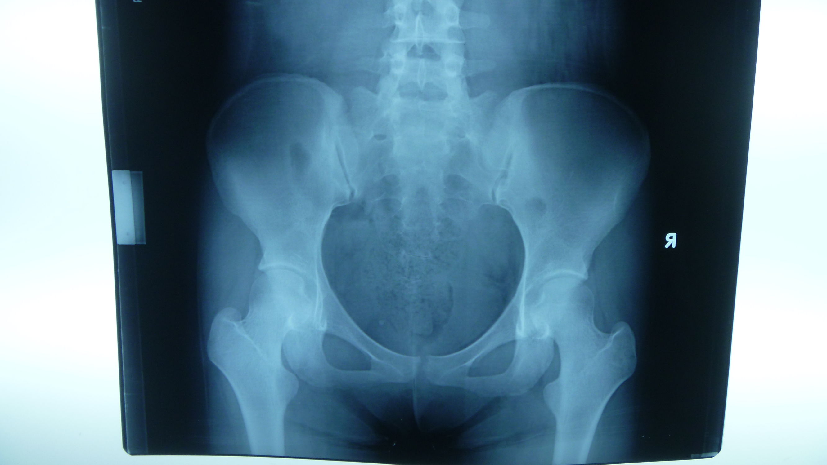 准妈妈必看孕期运动注意事项,孕期1-40周检查表明细表