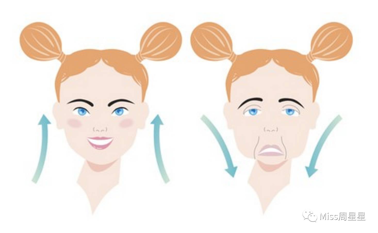 射频类美容仪能去除法令纹吗,改善抬头纹和法令纹的美容仪