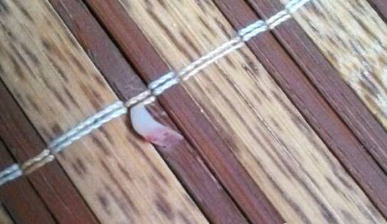 猫咪牙齿被划伤,猫咪牙齿被磕碎了