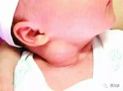 宝宝容易歪头怎么纠正,宝宝总是歪头杀怎么办