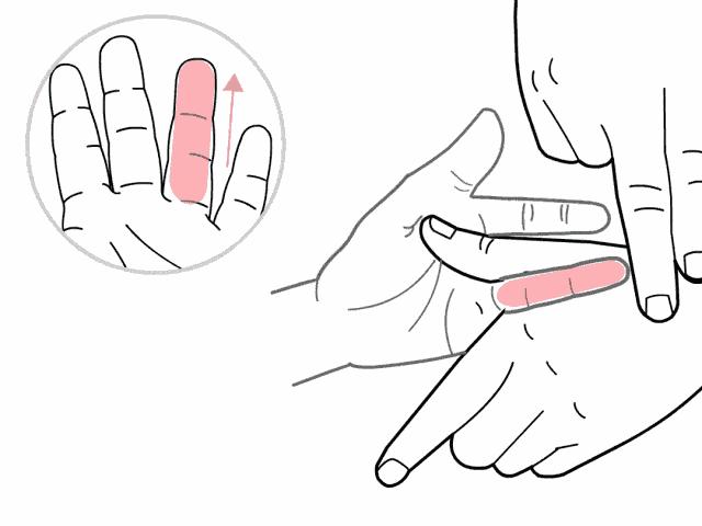 儿童扁桃体肥大切除手术后发烧,发烧引起扁桃体肿大要切除吗