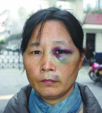 小女孩把别人的眼睛踢肿了，她奶奶说，踢死你也够不着判刑！