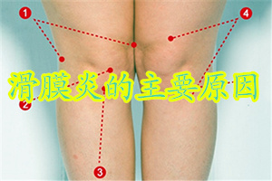 中老年滑膜炎是什么原因,滑膜炎的原因及治疗方法