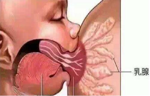 母乳堵奶最好的解决方法,堵奶自救母乳妈妈该怎么做