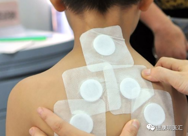 夏季贪凉猛吹空调惹上气管炎，中医告诉你正确疗法