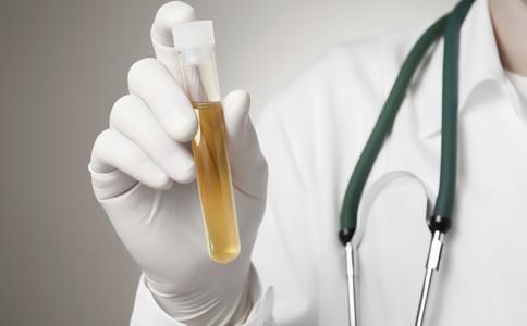 三分钟看懂尿常规报告之干化学法