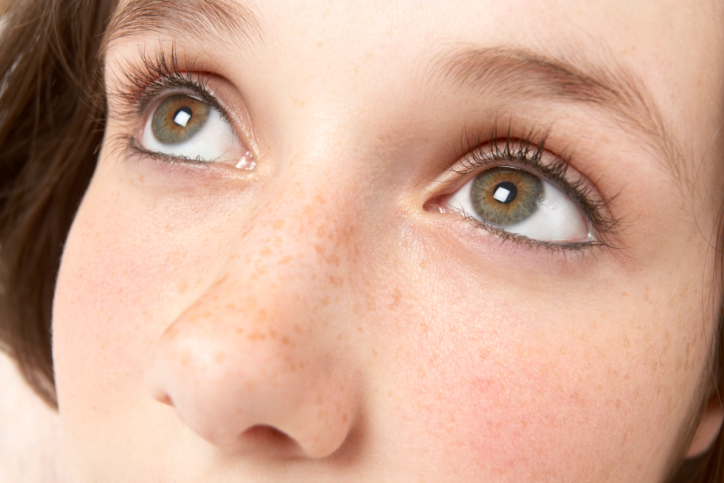 43岁女人脸上的黑褐斑怎么去除,脸上的黄褐斑点怎么去除