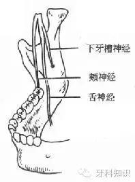 口腔拔牙图片,口腔拔牙麻醉多久消退