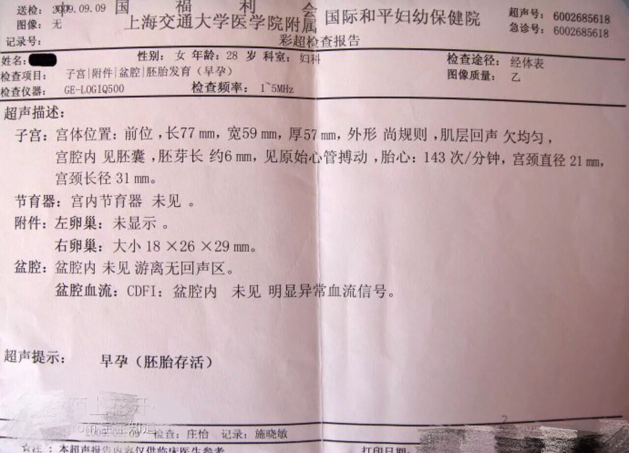 备孕常见问题解答：孕早期B超看不到孕囊怎么办？什么时候第一次B超最为合适？