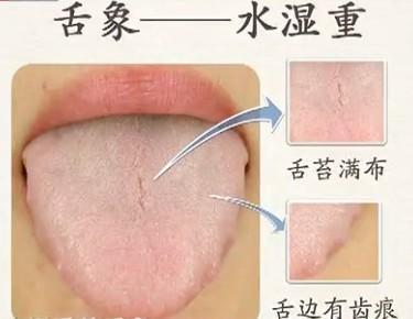 李铁红医生靠谱吗,舌头诊断疾病最简单的方法