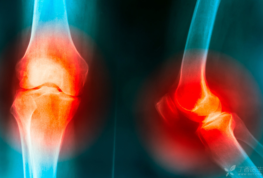 关节炎膝盖咯吱咯吱响是怎么回事,膝盖关节疼痛还嘎嘎响怎么办