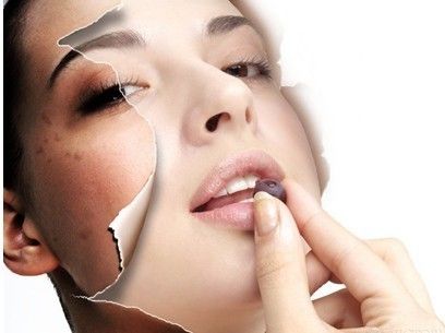 牙齿激光美白嘴唇受伤,激光美白牙齿危害亲身经历