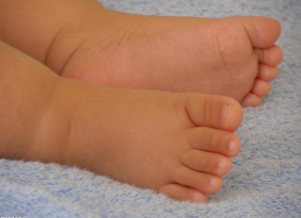 灰指甲加脚气长期不愈的后果,脚气是不是治不好治好了也会反复