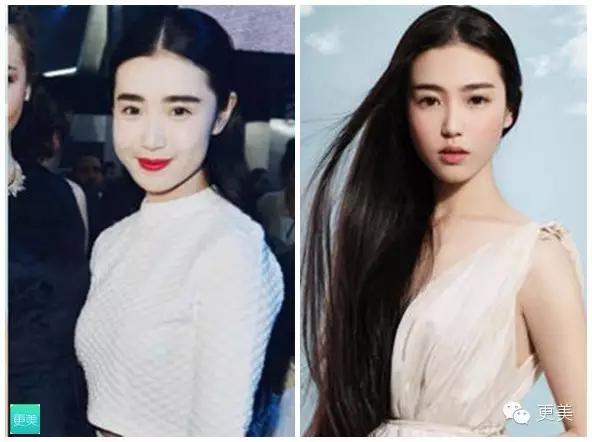 埋线美容线和不吸收线有什么区别,医院埋线和美容院埋线有什么差别