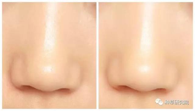 怎么才能让皮肤像水煮蛋样,怎样让皮肤像剥鸡蛋