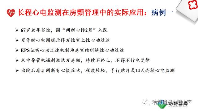 「心声」长程心电检测设备在房颤管理中的重要地位