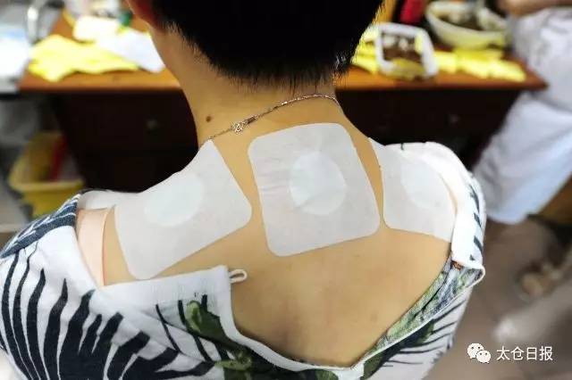 “三伏天”到正是“冬病夏治”好时机