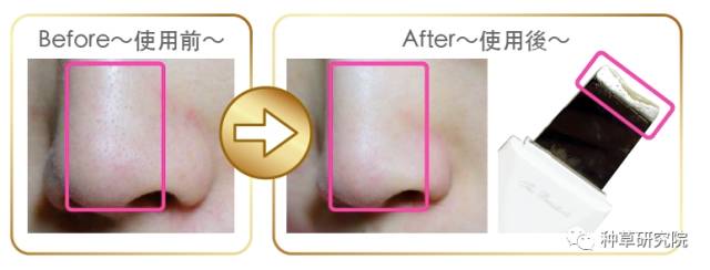 怎么让皮肤像剥壳鸡蛋一样光滑,怎么让皮肤滑的像鸡蛋