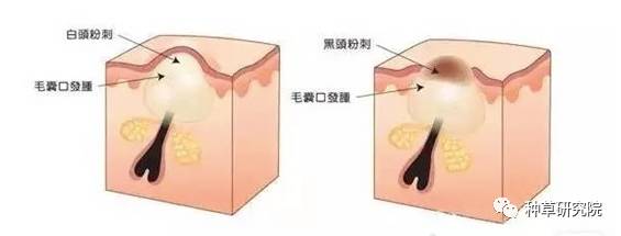 什么方法可以让皮肤嫩嫩滑滑,如何让皮肤光滑得像剥了壳的鸡蛋