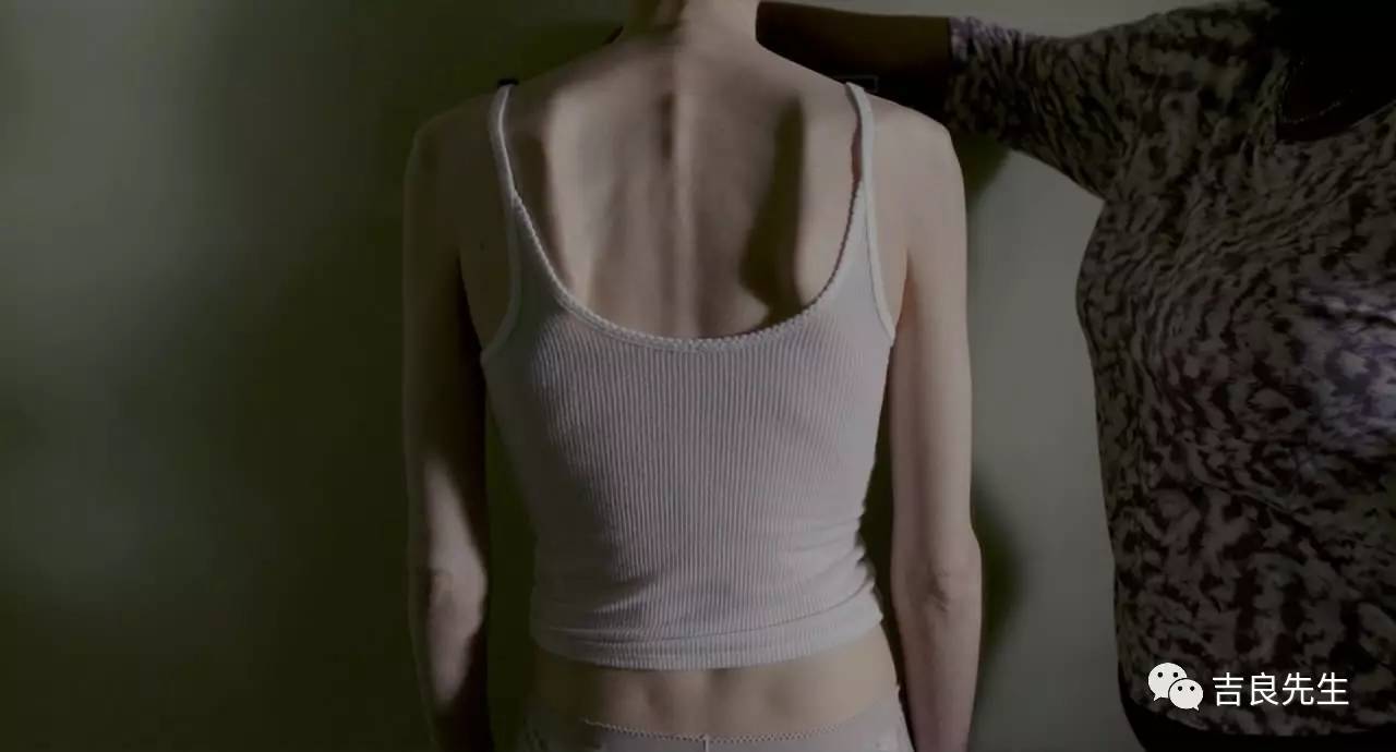 过度减肥的皮囊有多可怕？这位小公主就体验过