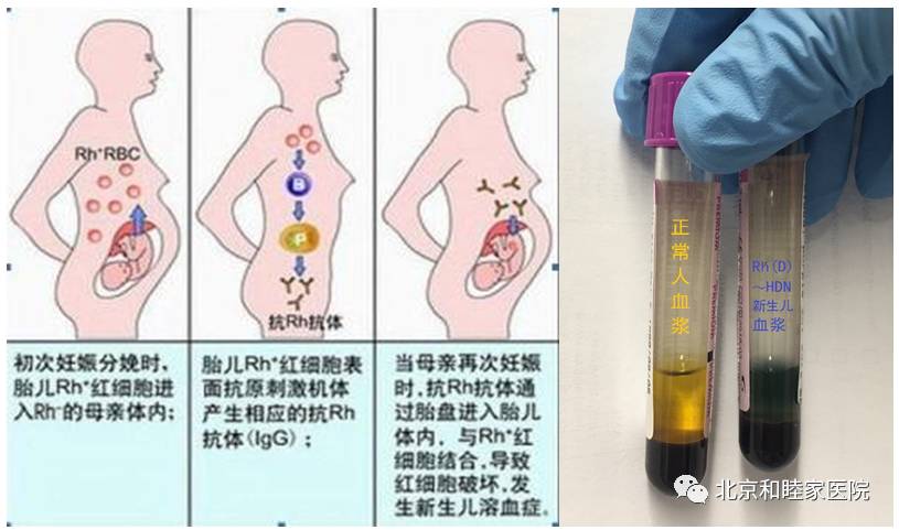 「和睦家长知识」稀缺的”熊猫血”，您了解多少？