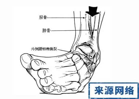 夏天如何保护脚踝不受凉,天气冷脚踝怎么保护