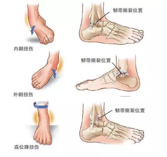 天气凉注意保护膝盖,冬天脚踝保护方法