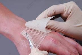 90度开水大面积烫伤急救,儿童开水烫伤急救处理