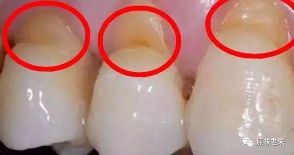 920爱牙日·牙齿酸软请心疼自己，80%的解决办法都在这里了，请自取