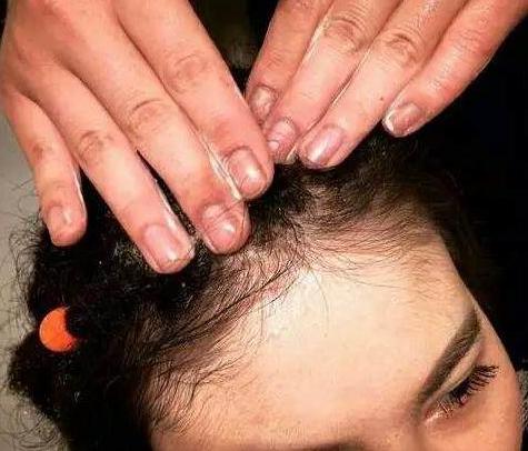 脏辫能每天洗头吗,洗脏辫的时候脏辫会散吗