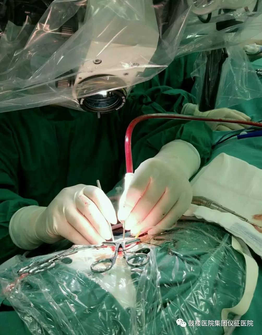 面瘫不恢复是因为风没出来吗,面瘫都是风的原因吗