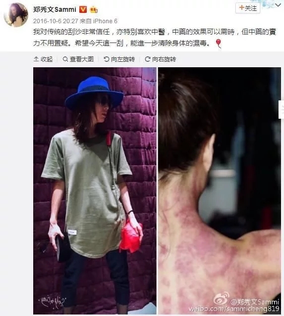 让众多明星痴迷的神秘东方医术!快来get明星同款!