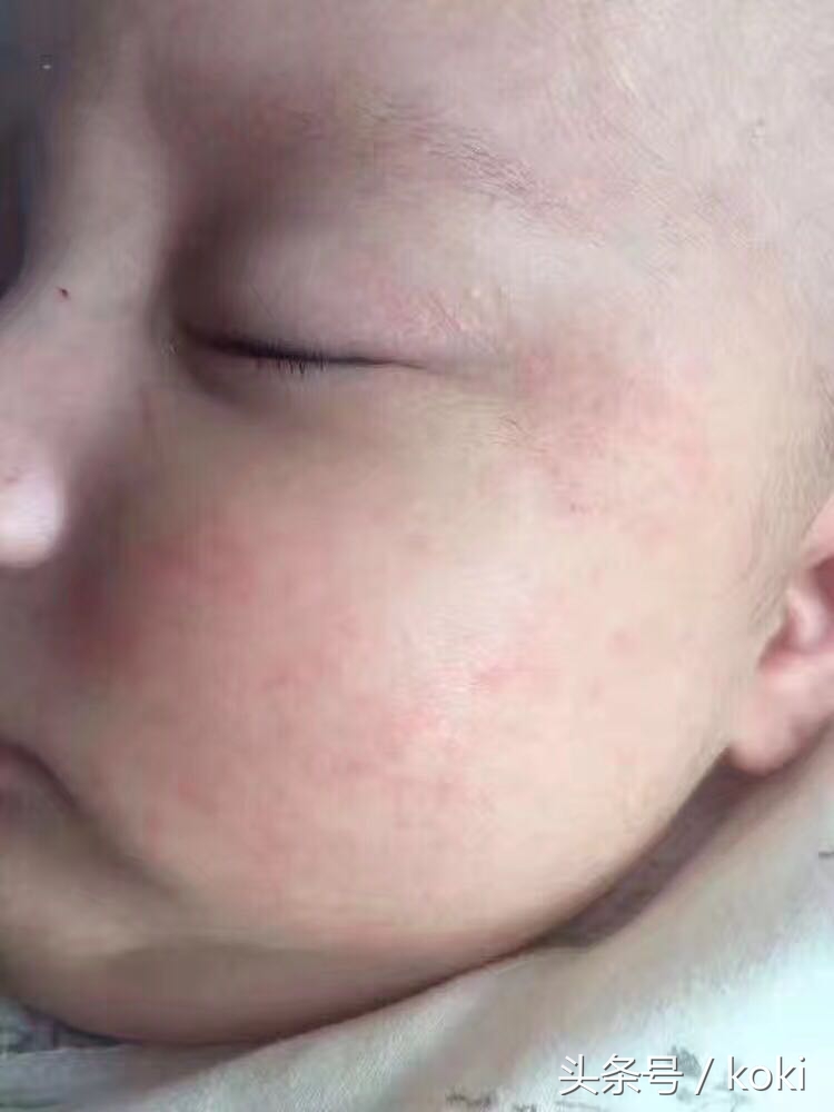 如果你是干性、中性、敏感性肌肤，脸上容易有表情纹、干纹、容易起皮缺少油脂该怎么拯救你的脸呢？