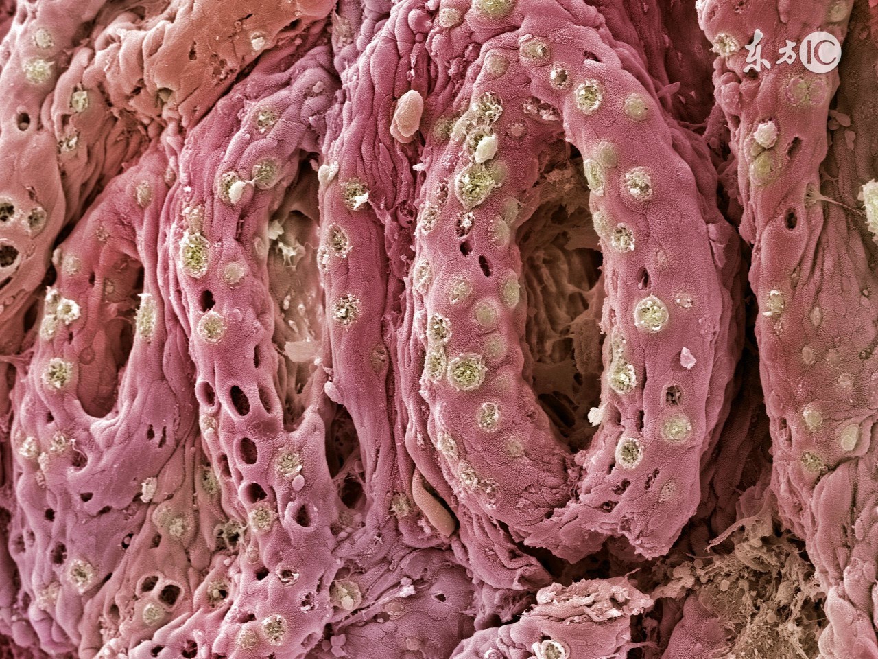 赶走腹泻从认知开始,学会与溃疡性结肠炎和平共处