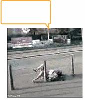 舌头太短是因为肾脏不好吗,舌头太短想变长