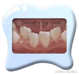 宝宝不爱吃软的食物,宝宝吃质地硬的食物有哪些