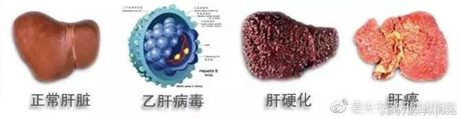 我要生活无肝扰生活中这些细节不注意，后果很很严重！